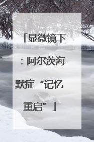 显微镜下：阿尔茨海默症“记忆重启”